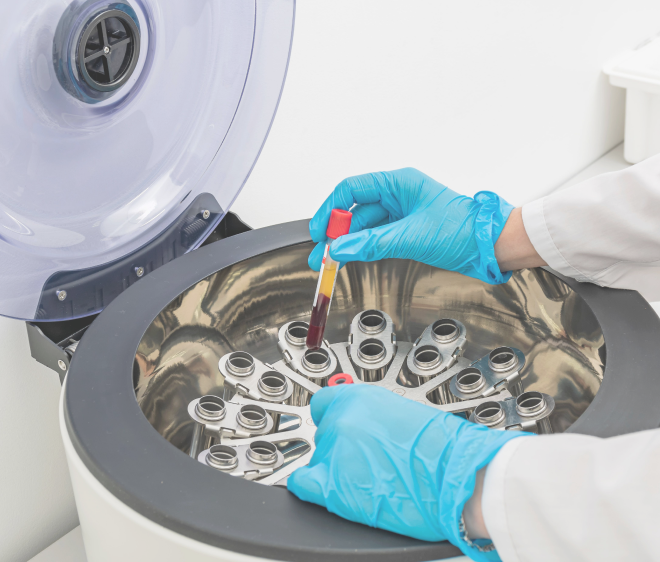Analytical Procedures