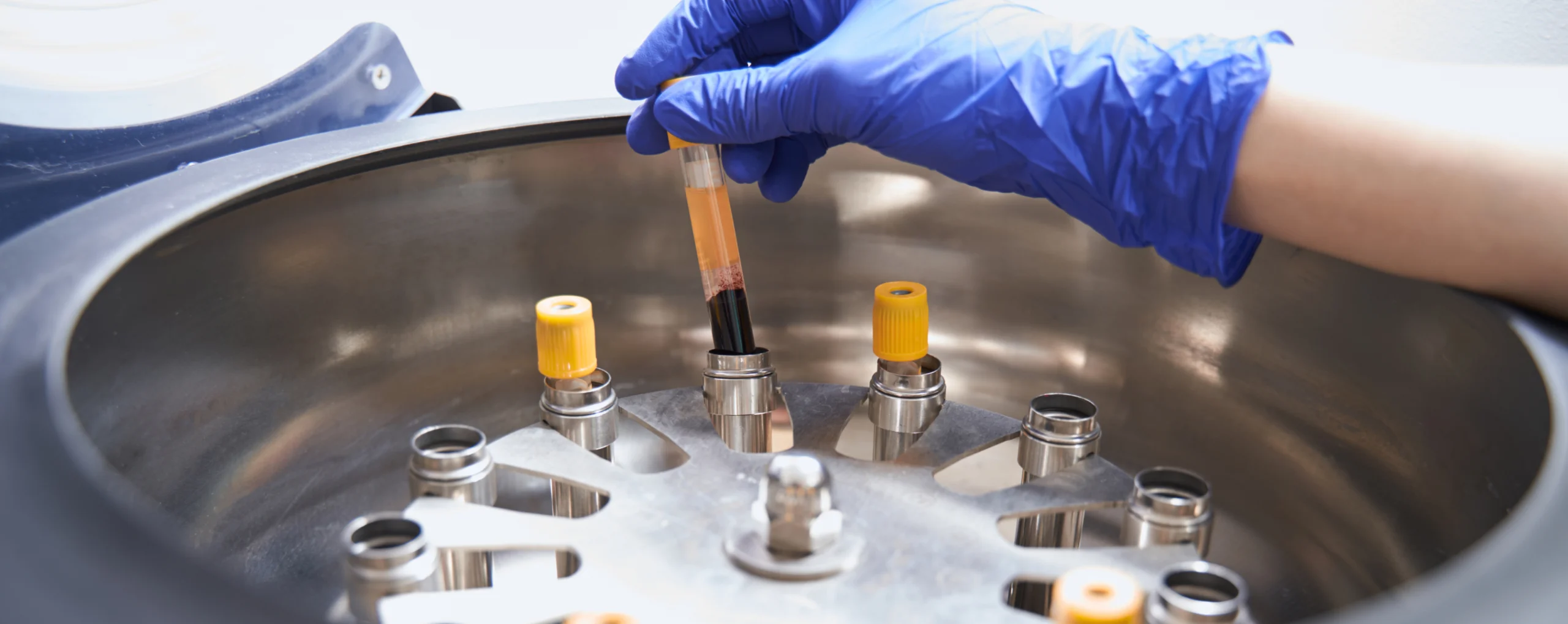 Rapid Method Development for an Urgent Preclinical Study