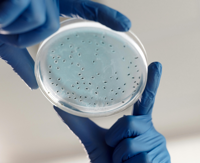 Sample Analysis